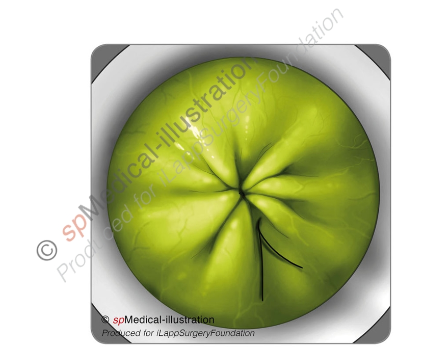 Perfect round shape of the access platform