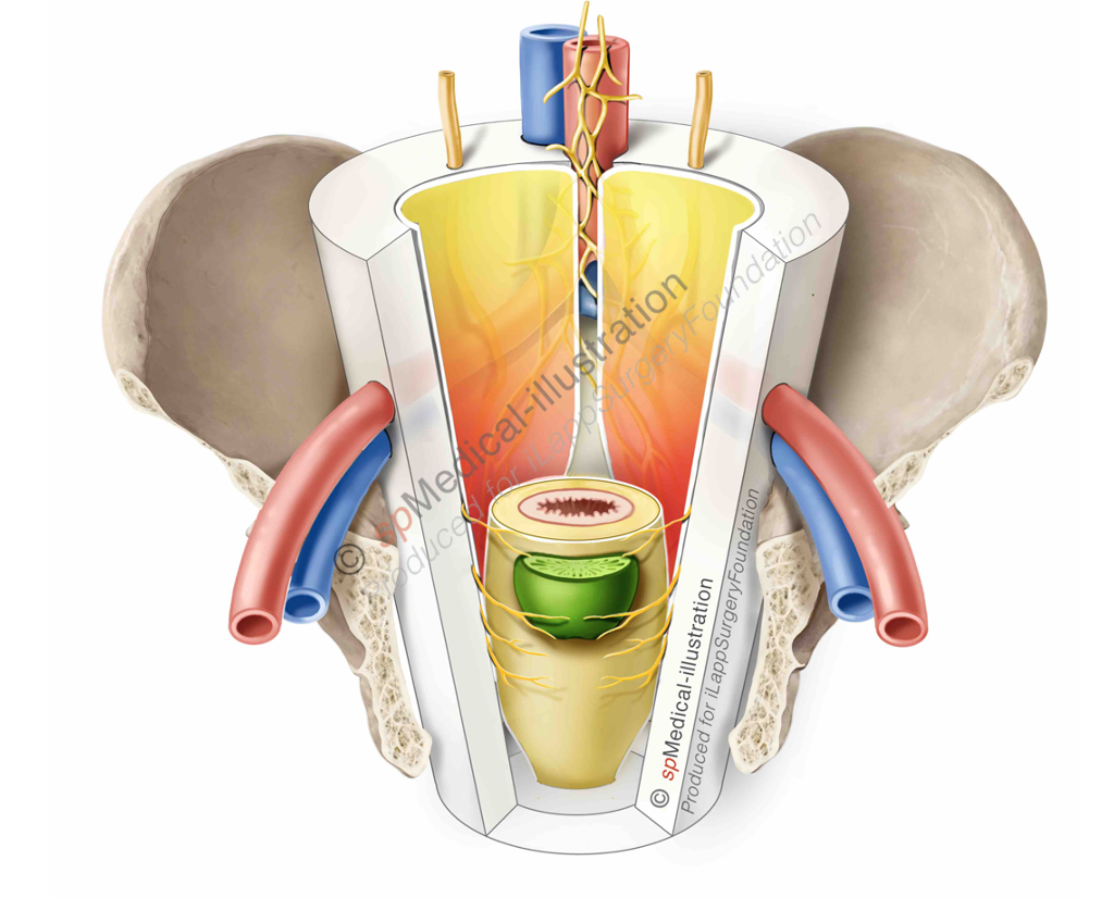 Kokertekening Definitief