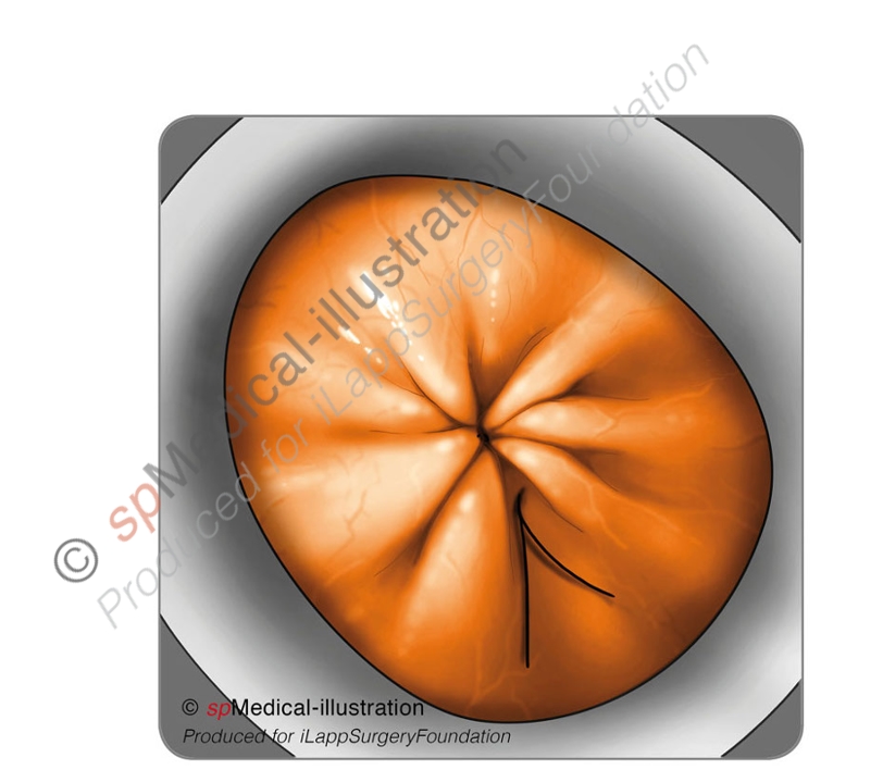 Perfect round shape of the access platform2