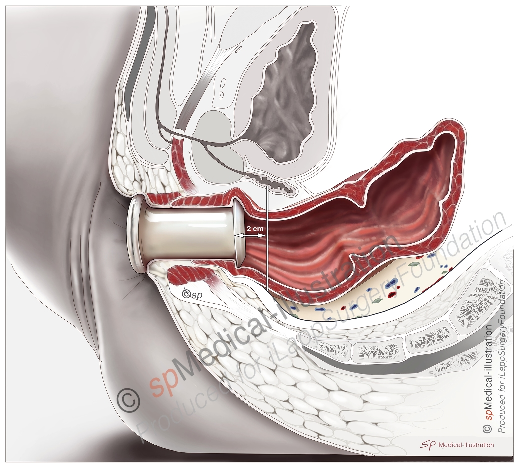 Installation of platform3