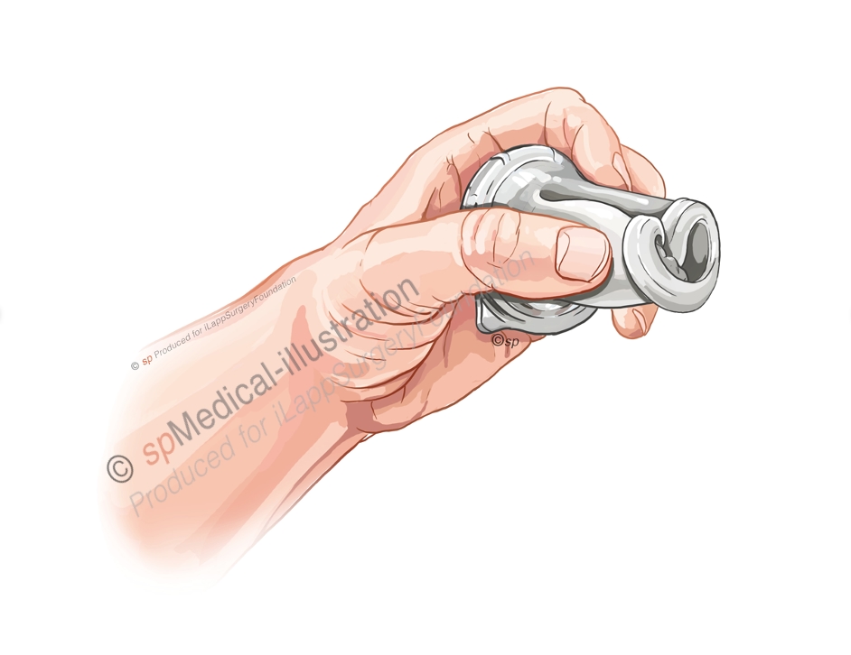 Installation of platform