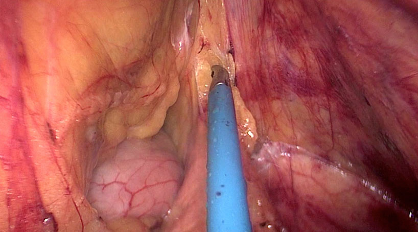 Anatomy and Embryology
