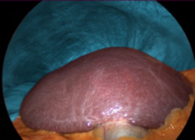 foto - Semiprone position: step by step 7